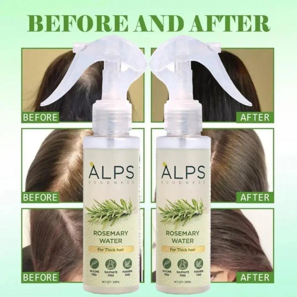 Alps Rosemary Water Hair Spray (Buy 2 get 1 Free)